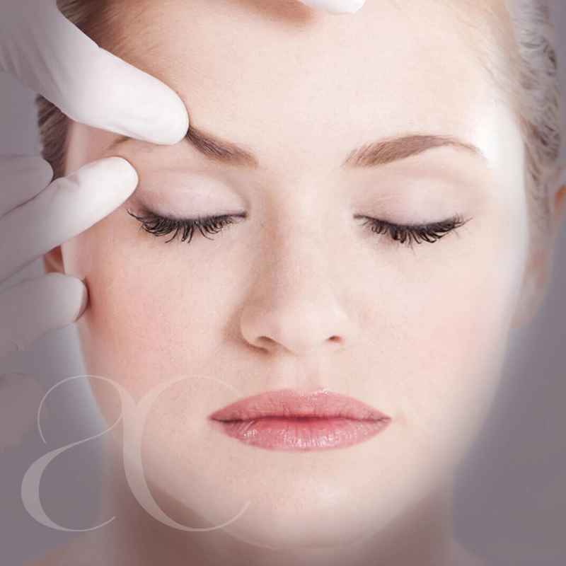 Blepharoplastik 1 Blepharoplastik